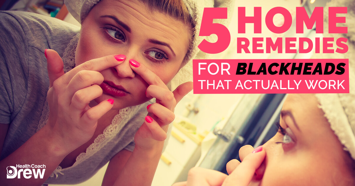 5 Home Remedies for Blackheads That Actually Work - Treating Blackheads At Home Fast